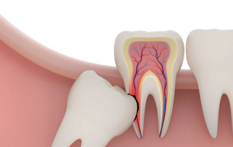 Cirurgia