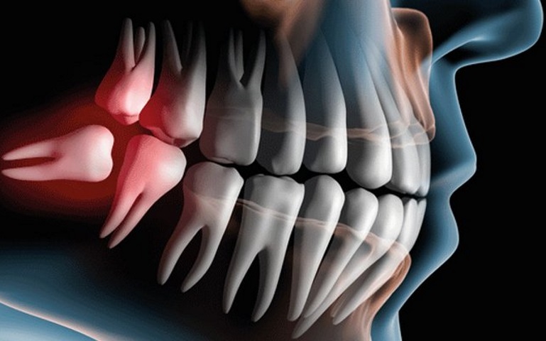 Cirurgia