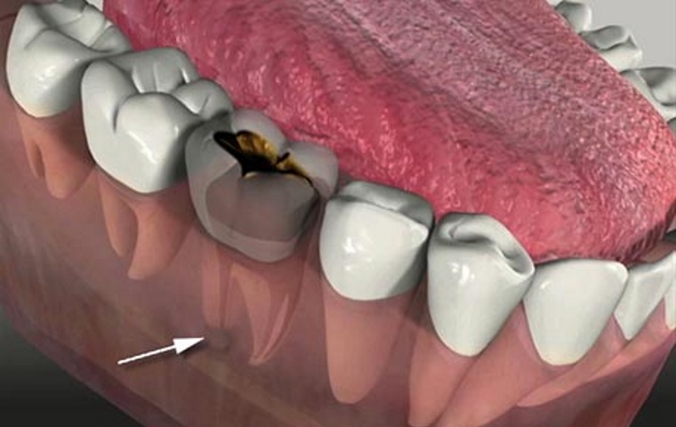 Endodontia