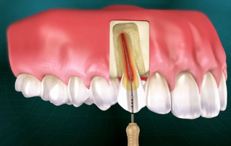 Endodontia