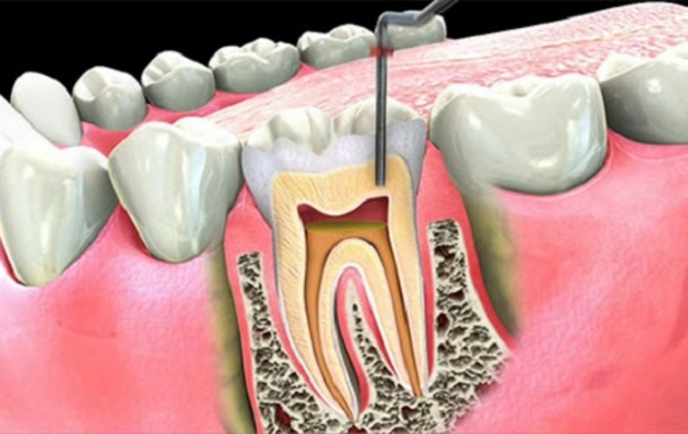 Endodontia